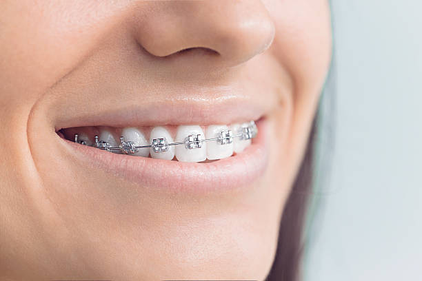 Best Traditional Braces  in Essex, IL